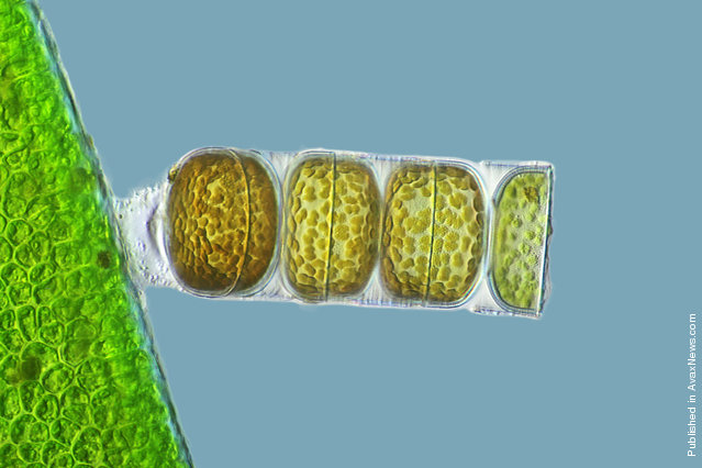Frank Fox of the Fachhochschule Trier in Trier, Germany took 3rd place with this image of a living specimen of Melosira moniliformis