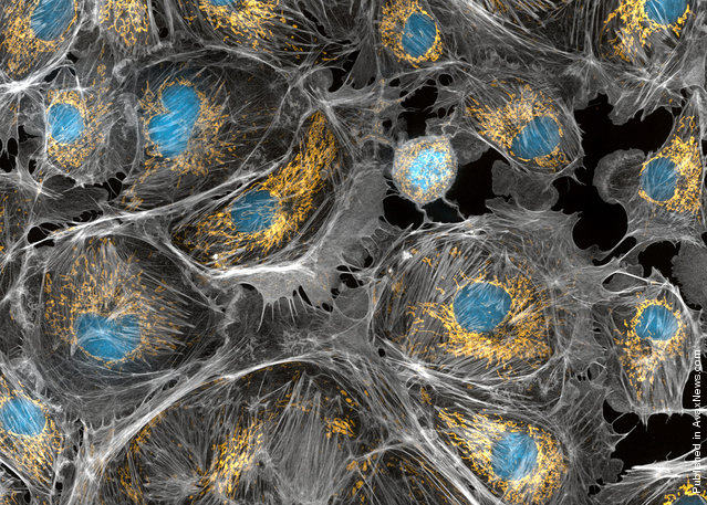 Dr. Torsten Wittmann of the University of California, San Fransisco, submitted this image of bovine pulmonary artery endothelial (BPAE) cells fixed and stained for actin, mitochondria, and DNA